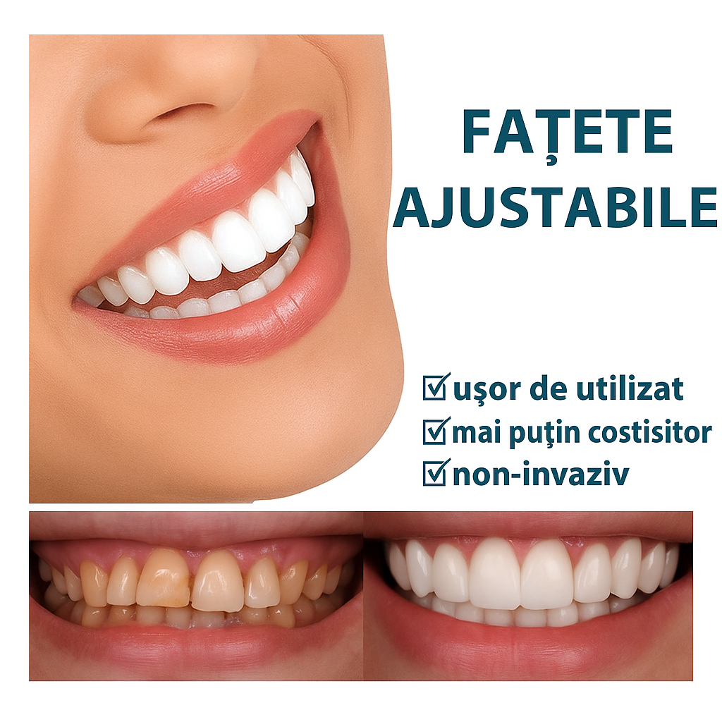 Fatete Dentare