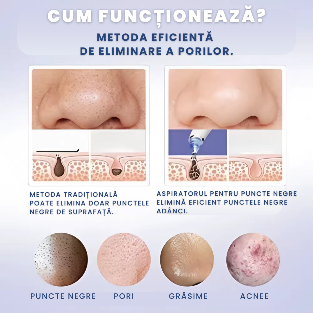 ASPIRATOR PUNCTE NEGRE