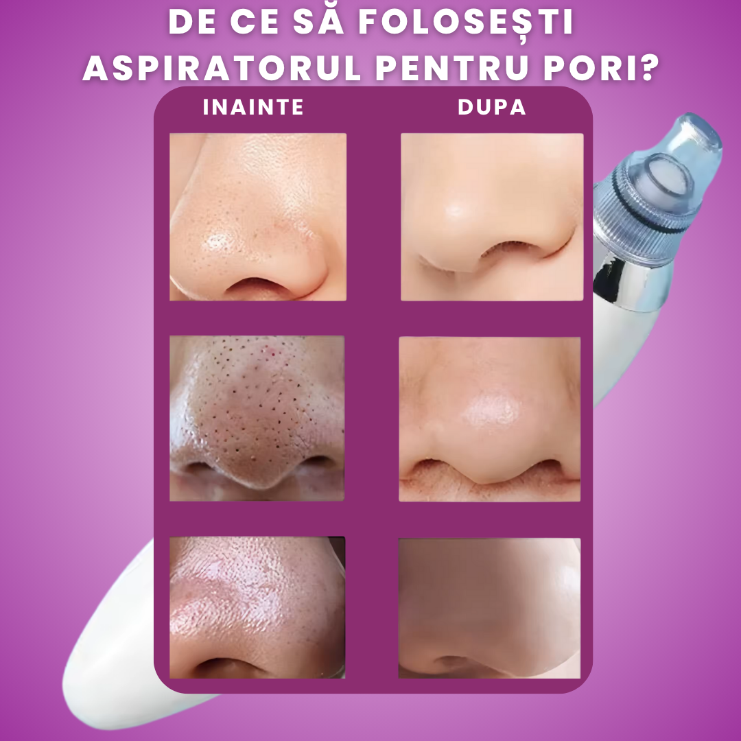 ASPIRATOR PUNCTE NEGRE